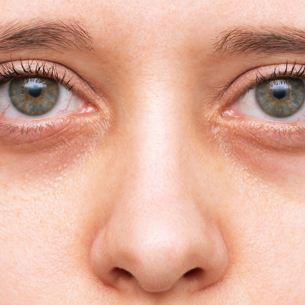 The Best Eye Creams for Dark Circles