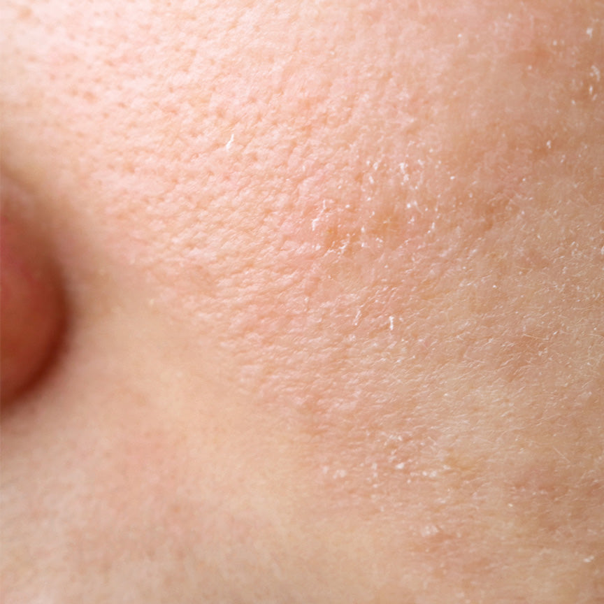 Moisturiser for Dry Skin What You Need to Know
