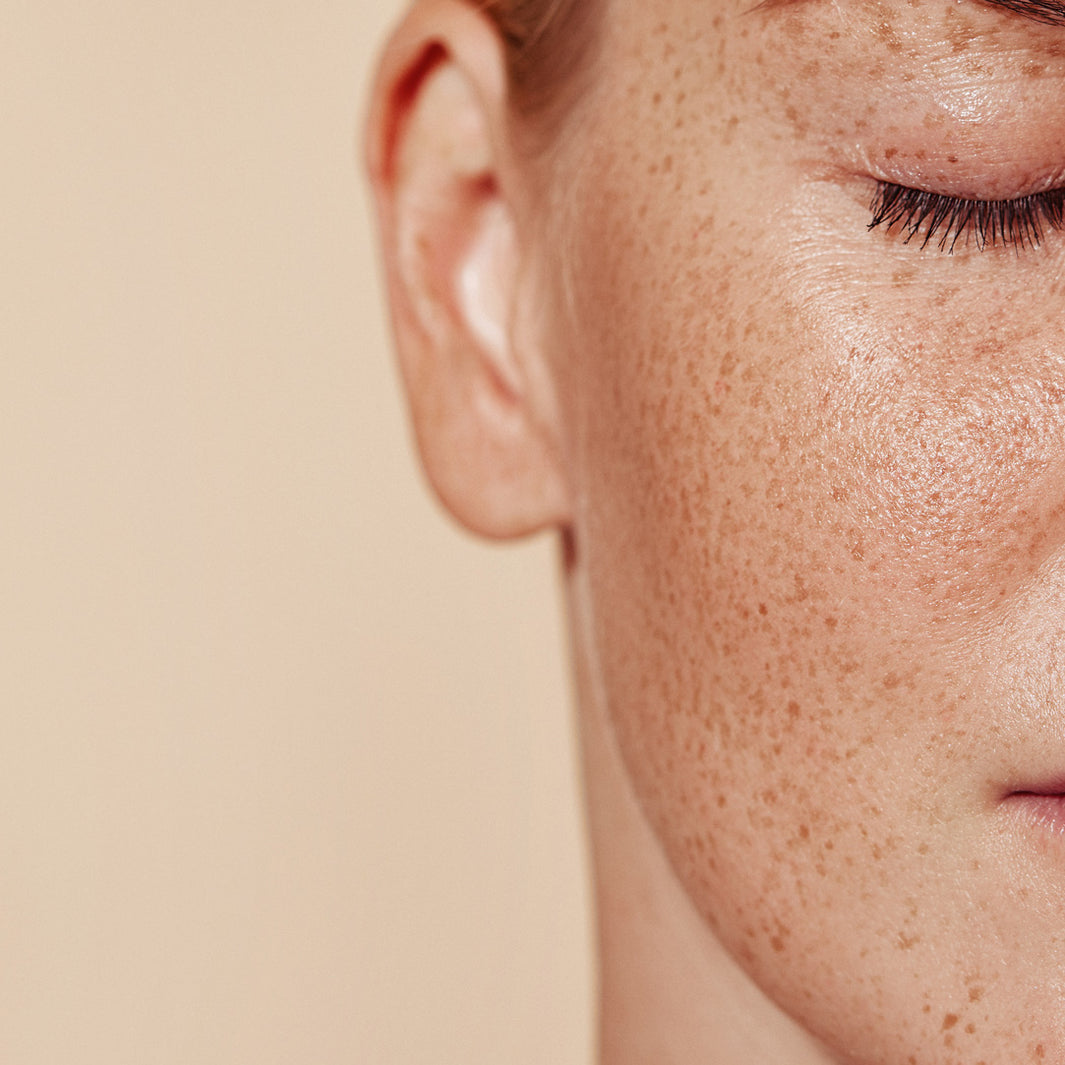 Winter & Skin
Managing Dry Skin in Winter